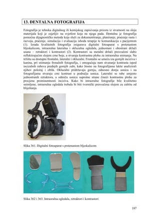 187
13. DENTALNA FOTOGRAFIJA
Fotografija je tehnika digitalnog ili kemijskog zapisivanja prizora iz stvarnosti na sloju
materijala koji je osjetljiv na svjetlost koja na njega pada. Dentalna je fotografija
pomoćna dijagnostička metoda koja služi za dokumentiranje, planiranje, praćenje rasta i
razvoja, praćenje, simulaciju i evaluaciju ishoda terapije te komunikaciju s pacijentom
(1). Izradu kvalitetnih fotografija osigurava digitalni fotoaparat s prstenastom
bljeskalicom, intraoralna lateralna i okluzalna ogledala, jednostani i obostrani držači
usana – retraktori i kontrastori (2). Kontrastori su metalni držači presvučeni slabo
reflektirajućim slojem crne boje, a stvaraju kontrastnu plohu za intraoralna snimanja. Na
tržištu su dostupni frontalni, lateralni i okluzalni. Frontalni se umeću iza gornjih inciziva i
kanina, pri snimanju fronalnih fotografija, i omogućuju nam stvaranje kontrasta ispod
incizalnih rubova prednjih gornjih zubi, kako bismo na fotografijama lakše analizirali
njihov položaj i oblik. Okluzalni pridržavaju gornju, odnosno donju usnicu i na
fotografijama stvaraju crni kontrast u području usnica. Lateralni se rabe umjesto
jednostranih retraktora, a odmiču usnicu suprotne strane čineći kontrastnu plohu za
procjenu prominentnosti inciziva. Kako bi intraoralne fotografije bile kvalitetno
snimljene, intraoralna ogledala trebala bi biti tvornički presvučena slojem za zaštitu od
bliještanja.
Slika 361. Digitalni fotoaparat s prstenastom bljeskalicom
Slika 362 i 363. Intraoralna ogledala, retraktori i kontrastori
 