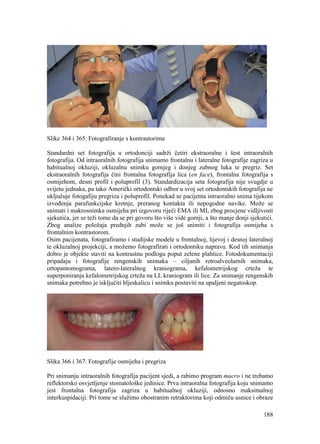 188
Slike 364 i 365. Fotografiranje s kontrastorima
Standardni set fotografija u ortodonciji sadrži četiri ekstraoralne i šest intraoralnih
fotografija. Od intraoralnih fotografija snimamo frontalnu i lateralne fotografije zagriza u
habitualnoj okluziji, okluzalnu snimku gornjeg i donjeg zubnog luka te pregriz. Set
ekstraoralnih fotografija čini frontalna fotografija lica (en face), frontalna fotografija s
osmijehom, desni profil i poluprofil (3). Standardizacija seta fotografija nije svugdje u
svijetu jednaka, pa tako Američki ortodontski odbor u svoj set ortodontskih fotografija ne
uključuje fotogafiju pregriza i poluprofil. Ponekad se pacijenta intraoralno snima tijekom
izvođenja parafunkcijske kretnje, preranog kontakta ili nepogodne navike. Može se
snimati i makrosnimka osmijeha pri izgovoru riječi EMA ili MI, zbog procjene vidljivosti
sjekutića, jer se teži tome da se pri govoru što više vide gornji, a što manje donji sjekutići.
Zbog analize položaja prednjih zubi može se još snimiti i fotografija osmijeha s
frontalnim kontrastorom.
Osim pacijenata, fotografiramo i studijske modele u frontalnoj, lijevoj i desnoj lateralnoj
te okluzalnoj projekciji, a možemo fotografirati i ortodontsku napravu. Kod tih snimanja
dobro je objekte staviti na kontrastnu podlogu poput zelene plahtice. Fotodokumentaciji
pripadaju i fotografije rengenskih snimaka – ciljanih retroalveolarnih snimaka,
ortopantomograma, latero-lateralnog kraniograma, kefalometrijskog crteža te
superponiranja kefalometrijskog crteža na LL kraniogram ili lice. Za snimanje rengenskih
snimaka potrebno je isključiti bljeskalicu i snimku postaviti na upaljeni negatoskop.
Slika 366 i 367. Fotografije osmijeha i pregriza
Pri snimanju intraoralnih fotografija pacijent sjedi, a rabimo program macro i ne trebamo
reflektorsko osvjetljenje stomatološke jedinice. Prva intraoralna fotografija koju snimamo
jest frontalna fotografija zagriza u habitualnoj okluziji, odnosno maksimalnoj
interkuspidaciji. Pri tome se služimo obostranim retraktorima koji odmiču usnice i obraze
 