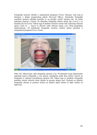 193
Fotografije možemo obraditi u namjenskom programu Picture Manager, koji nam je
dostupan u sklopu programskog paketa Microsoft Officea. Intraoralne fotografije
snimljene pomoću ogledala potrebno je na početku zrcaliti opcijom flip, da realno
prikazuju situaciju u ustima. Za okluzalne fotografije rabimo opciju flip vertical, a za
lateralne flip horizontal. Nakon toga ih dodatno možemo rotirati radi centriranja izborom
opcije rotate by __ degree te obrezati višak izborom opcije crop. Zbog preglednije
dokumentacije, od prebačenih fotografija možemo načiniti prikaz pacijenta u
namjenskom programu Power Pointu.
Slika 383. Obrezivanje viška fotografije opcijom crop. Povlačenjem dvaju dijametralno
suprotnih kuteva fotografije u dva poteza, omeđujemo polje koje želimo ostaviti na
fotografiji te izabrano potvrđujemo opcijom OK. Nakon toga je obrađenu fotografiju
potrebno snimiti izborom ikone diskete na gornjoj alatnoj traci. Prelazak na sljedeću
fotografiju obavlja se pomoću strelica na donjem dijelu ekrana ili tipke strelica na
tipkovnici.
 