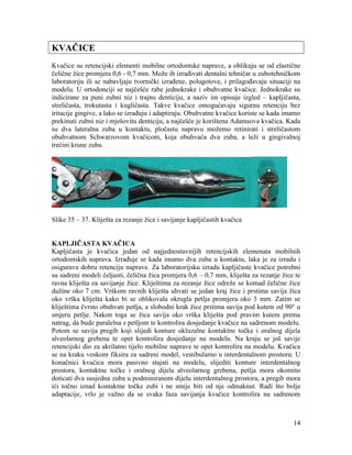 14
KVAČICE
Kvačice su retencijski elementi mobilne ortodontske naprave, a oblikuju se od elastične
čelične žice promjera 0,6 - 0,7 mm. Može ih izrađivati dentalni tehničar u zubotehničkom
laboratoriju ili se nabavljaju tvornički izrađene, polugotove, i prilagođavaju situaciji na
modelu. U ortodonciji se najčešće rabe jednokrake i obuhvatne kvačice. Jednokrake su
indicirane za puni zubni niz i trajnu denticiju, a naziv im opisuje izgled – kapljičasta,
streličasta, trokutasta i kugličasta. Takve kvačice omogućavaju sigurnu retenciju bez
iritacije gingive, a lako se izrađuju i adaptiraju. Obuhvatne kvačice koriste se kada imamo
prekinuti zubni niz i mješovitu denticiju, a najčešće je korištena Adamsova kvačica. Kada
su dva lateralna zuba u kontaktu, pločastu napravu možemo retinirati i streličastom
obuhvatnom Schwarzovom kvačicom, koja obuhvaća dva zuba, a leži u gingivalnoj
trećini krune zuba.
Slike 35 – 37. Kliješta za rezanje žice i savijanje kapljičastih kvačica
KAPLJIČASTA KVAČICA
Kapljičasta je kvačica jedan od najjednostavnijih retencijskih elemenata mobilnih
ortodontskih naprava. Izrađuje se kada imamo dva zuba u kontaktu, laka je za izradu i
osigurava dobru retenciju naprave. Za laboratorijsku izradu kapljičaste kvačice potrebni
su sadreni modeli čeljusti, čelična žica promjera 0,6 – 0,7 mm, kliješta za rezanje žice te
ravna kliješta za savijanje žice. Kliještima za rezanje žice odreže se komad čelične žice
dužine oko 7 cm. Vrškom ravnih kliješta uhvati se jedan kraj žice i prstima savija žica
oko vrška kliješta kako bi se oblikovala okrugla petlja promjera oko 3 mm. Zatim se
kliještima čvrsto obuhvati petlja, a slobodni krak žice prstima savija pod kutem od 90° u
smjeru petlje. Nakon toga se žica savija oko vrška kliješta pod pravim kutem prema
natrag, da bude paralelna s petljom te kontrolira dosjedanje kvačice na sadrenom modelu.
Potom se savija pregib koji slijedi konture okluzalne kontaktne točke i oralnog dijela
alveolarnog grebena te opet kontrolira dosjedanje na modelu. Na kraju se još savije
retencijski dio za akrilatno tijelo mobilne naprave te opet kontrolira na modelu. Kvačica
se na kraku voskom fiksira za sadreni model, vestibularno u interdentalnom prostoru. U
konačnici kvačica mora pasivno stajati na modelu, slijediti konture interdentalnog
prostora, kontaktne točke i oralnog dijela alveolarnog grebena, petlja mora okomito
doticati dva susjedna zuba u podminiranom dijelu interdentalnog prostora, a pregib mora
ići točno iznad kontaktne točke zubi i ne smije biti od nje odmaknut. Radi što bolje
adaptacije, vrlo je važno da se svaka faza savijanja kvačice kontrolira na sadrenom
 