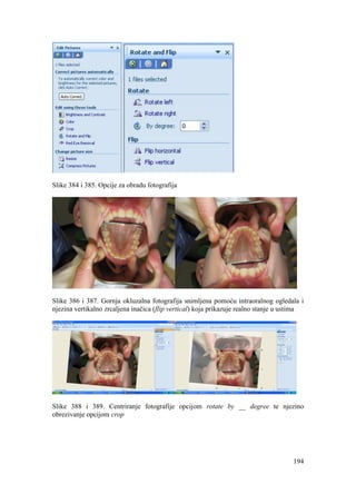194
Slike 384 i 385. Opcije za obradu fotografija
Slike 386 i 387. Gornja okluzalna fotografija snimljena pomoću intraoralnog ogledala i
njezina vertikalno zrcaljena inačica (flip vertical) koja prikazuje realno stanje u ustima
Slike 388 i 389. Centriranje fotografije opcijom rotate by __ degree te njezino
obrezivanje opcijom crop
 