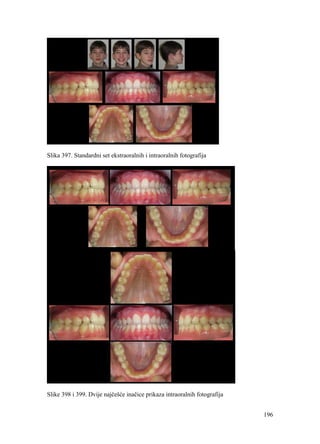 196
Slika 397. Standardni set ekstraoralnih i intraoralnih fotografija
Slike 398 i 399. Dvije najčešće inačice prikaza intraoralnih fotografija
 