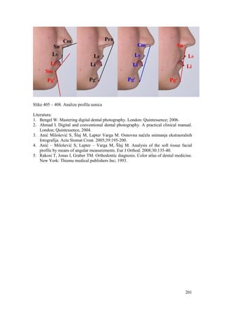 201
Slike 405 – 408. Analize profila usnica
Literatura:
1. Bengel W. Mastering digital dental photography. London: Quintessence; 2006.
2. Ahmad I. Digital and conventional dental photography. A practical clinical manual.
London; Quintessence, 2004.
3. Anić Milošević S, Šlaj M, Lapter Varga M. Osnovna načela snimanja ekstraoralnih
fotografija. Acta Stomat Croat. 2005;39:195-200.
4. Anić – Milošević S, Lapter – Varga M, Šlaj M. Analysis of the soft tissue facial
profile by means of angular measurements. Eur J Orthod. 2008;30:135-40.
5. Rakosi T, Jonas I, Graber TM. Orthodontic diagnosis. Color atlas of dental medicine.
New York: Thieme medical publishers Inc; 1993.
 
