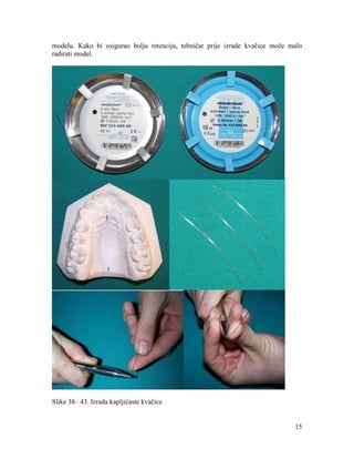 15
modelu. Kako bi osigurao bolju retenciju, tehničar prije izrade kvačice može malo
radirati model.
Slike 38– 43. Izrada kapljičaste kvačice
 