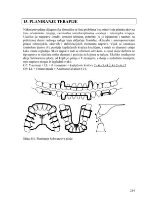 214
15. PLANIRANJE TERAPIJE
Nakon provedene dijagnostike formulira se lista problema i na osnovi nje planira aktivna
faza ortodontske terapije, eventualna interdisciplinarna suradnja i retencijska terapija.
Ukoliko će naparavu izraditi dentalni tehničar, potrebno ju je isplanirati i nacrtati na
priloženoj shemi radnoga naloga koja uključuje frontalni, okluzalni i anteroposteriorni
prikaz retencijskih, aktivnih i stabilizacijskih elemenata naprave. Vijak se označava
simbolom ljestve (#), pozicija kapljičastih kvačica kružićem, a ostali se elementi crtaju
kako zaista izgledaju. Skica naprave radi se običnom olovkom, a ispod skice definira se
tip naprave te riječima opišu elementi i pozicije na kojima se nalaze. Ukoliko izrađujemo
dvije Schwarzove ploče, od kojih je gornja s Y-rezanjem, a donja s uzdužnim rezanjem,
opis naprave mogao bi izgledati ovako:
GP: Y-rezanje + LL + # trosmjerni + kapljičaste kvačice 7 • 6 • 5 • 4 │ 4 • 5 • 6 • 7
DP: LL + # transverzala + Adamsove kvačice 6 i 6.
Slika 410. Planiranje Schwarzove ploče
 