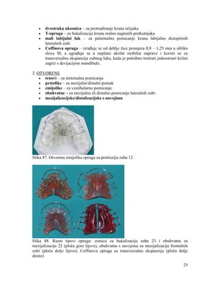 25
dvostruka ukosnica – za protrudiranje kruna očnjaka
T-opruga – za bukalizaciju kruna oralno nagnutih pretkutnjaka
mali labijalni luk – za palatinalno pomicanje kruna labijalno distopičnih
lateralnih zubi
Coffinova opruga – izrađuje se od deblje žice promjera 0,9 – 1,25 mm u obliku
slova M, a ugrađuje se u nepčani akrilat mobilne naprave i koristi se za
transverzalnu ekspanziju zubnog luka, kada je potrebno tretirati jednostrani križni
zagriz s devijacijom mandibule.
2. OTVORENE
trnovi – za minimalna pomicanja
prstolike – za mezijalni/distalni pomak
zmijolike – za vestibularno pomicanje
obuhvatne – za mezijalno ili distalno pomicanje lateralnih zubi
mezijalizacijske/distalizacijske s navojima
Slika 87. Otvorena zmijolika opruga za protruziju zuba 12
Slika 88. Razni tipovi opruga: osmica za bukalizaciju zuba 23 i obuhvatna za
mezijalizaciju 22 (ploča gore lijevo), obuhvatna s navojima za mezijalizaciju frontalnih
zubi (ploča dolje lijevo), Coffinova opruga za transverzalnu ekspanziju (ploča dolje
desno)
 