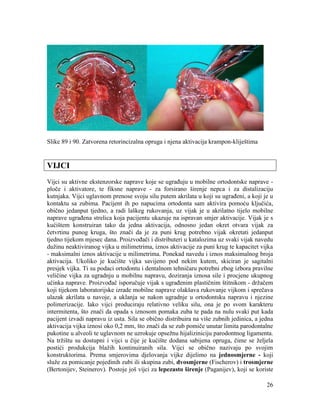 26
Slike 89 i 90. Zatvorena retorincizalna opruga i njena aktivacija krampon-kliještima
VIJCI
Vijci su aktivne ekstenzorske naprave koje se ugrađuju u mobilne ortodontske naprave -
ploče i aktivatore, te fiksne naprave - za forsirano širenje nepca i za distalizaciju
kutnjaka. Vijci uglavnom prenose svoju silu putem akrilata u koji su ugrađeni, a koji je u
kontaktu sa zubima. Pacijent ih po napucima ortodonta sam aktivira pomoću ključića,
obično jedanput tjedno, a radi laškeg rukovanja, uz vijak je u akrilatno tijelo mobilne
naprave ugrađena strelica koja pacijentu ukazuje na ispravan smjer aktivacije. Vijak je s
kućištem konstruiran tako da jedna aktivacija, odnosno jedan okret otvara vijak za
četvrtinu punog kruga, što znači da je za puni krug potrebno vijak okretati jedanput
tjedno tijekom mjesec dana. Proizvođači i distributeri u katalozima uz svaki vijak navedu
dužinu neaktiviranog vijka u milimetrima, iznos aktivacije za puni krug te kapacitet vijka
- maksimalni iznos aktivacije u milimetrima. Ponekad navedu i iznos maksimalnog broja
aktivacija. Ukoliko je kućište vijka savijeno pod nekim kutem, skiciran je sagitalni
presjek vijka. Ti su podaci ortodontu i dentalnom tehničaru potrebni zbog izbora pravilne
veličine vijka za ugradnju u mobilnu napravu, doziranja iznosa sile i procjene ukupnog
učinka naprave. Proizvođač isporučuje vijak s ugrađenim plastičnim štitnikom - držačem
koji tijekom laboratorijske izrade mobilne naprave olakšava rukovanje vijkom i sprečava
ulazak akrilata u navoje, a uklanja se nakon ugradnje u ortodontsku napravu i njezine
polimerizacije. Iako vijci produciraju relativno veliku silu, ona je po svom karakteru
intermitenta, što znači da opada s iznosom pomaka zuba te pada na nulu svaki put kada
pacijent izvadi napravu iz usta. Sila se obično distribuira na više zubnih jedinica, a jedna
aktivacija vijka iznosi oko 0,2 mm, što znači da se zub pomiče unutar limita parodontalne
pukotine u alveoli te uglavnom ne uzrokuje opsežnu hijaliziniciju parodontnog ligamenta.
Na tržištu su dostupni i vijci u čije je kućište dodana sabijena opruga, čime se željela
postići produkcija blažih kontinuiranih sila. Vijci se obično nazivaju po svojim
konstruktorima. Prema smjerovima djelovanja vijke dijelimo na jednosmjerne - koji
služe za pomicanje pojedinih zubi ili skupina zubi, dvosmjerne (Fischerov) i trosmjerne
(Bertonijev, Steinerov). Postoje još vijci za lepezasto širenje (Paganijev), koji se koriste
 