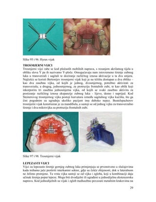 29
Slike 95 i 96. Hyrax vijak
TROSMJERNI VIJCI
Trosmjerni vijci rabe se kod pločastih mobilnih naprava, s rezanjem akrilatnog tijela u
obliku slova Y pa ih nazivamo Y-ploče. Omogućavaju nam istovremeno širenje zubnog
luka u transverzali i sagitali te doziranje različitog iznosa aktivacije u ta dva smjera.
Najčešće se koristi Bertonijev trosmjerni vijak koji je na tržištu dostupan u dva oblika –
kao dva zasebna vijka, od kojih je jednog, dvosmjernog, potrebno aktivirati za
transverzalu, a drugog, jednosmjernog, za protruziju frontalnih zubi, te kao oblik koji
inkorporira tri zasebna jednosmjerna vijka, od kojih se svaki zasebno aktivira za
postizanje različitog iznosa ekspanzije zubnog luka - lijevo, desno i naprijed. Kod
Steinerovog trosmjernog vijka postoji kurvatura između sagitalnog vijka kućišta, što ga
čini pogodnim za ugradnju ukoliko pacijent ima duboko nepce. Beutelspacherov
trosmjerni vijak konstruiran je za mandibulu, a sastoji se od jednog vijka za transverzalno
širenje i dva mikrovijka za protruziju frontalnih zubi.
Slike 97 i 98. Trosmjerni vijak
LEPEZASTI VIJCI
Vijci za lepezasto širenje gornjeg zubnog luka primjenjuju se prvenstveno u slučajevima
kada trebamo jače proširiti interkanini sektor, gdje su češće zbijenosti, dok u lateralnom
ne želimo promjene. Ta vrsta vijka sastoji se od vijka i zgloba, koji u kombinaciji daju
učinak širenja poput lepeze. Mogu biti dvodijelni ili ugrađeni u jednodijelnu ekstenzorsku
napravu. Kod jednodijelnih su vijak i zglob međusobno povezani metalnim krakovima na
 