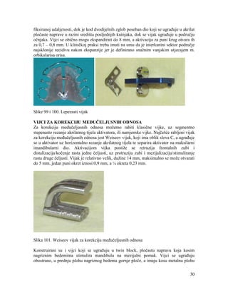 30
fiksiranoj udaljenosti, dok je kod dvodijelnih zglob poseban dio koji se ugrađuje u akrilat
pločaste naprave u razini središta posljednjih kutnjaka, dok se vijak ugrađuje u području
očnjaka. Vijci se obično mogu ekspandirati do 8 mm, a aktivacija za puni krug otvara ih
za 0,7 – 0,8 mm. U kliničkoj praksi treba imati na umu da je interkanini sektor područje
najsklonije recidivu nakon ekspanzije jer je definirano snažnim vanjskim utjecajem m.
orbikularisa orisa.
Slike 99 i 100. Lepezasti vijak
VIJCI ZA KOREKCIJU MEĐUČELJUSNIH ODNOSA
Za korekciju međučeljusnih odnosa možemo rabiti klasične vijke, uz segmentno
stepenasto rezanje akrilatnog tijela aktivatora, ili namjenske vijke. Najčešće rabljeni vijak
za korekciju međučeljusnih odnosa jest Weiseov vijak, koji ima oblik slova C, a ugrađuje
se u aktivator uz horizontalno rezanje akrilatnog tijela te separira aktivator na maksilarni
imandibularni dio. Aktivacijom vijka postiže se retruzija frontalnih zubi i
distalizacija/kočenje rasta jedne čeljusti, uz protruziju zubi i mezijalizaciju/stimuliranje
rasta druge čeljusti. Vijak je relativno velik, dužine 14 mm, maksimalno se može otvarati
do 5 mm, jedan puni okret iznosi 0,9 mm, a ¼ okreta 0,23 mm.
Slika 101. Weiseov vijak za korekciju međučeljusnih odnosa
Konstruirani su i vijci koji se ugrađuju u twin block, pločastu napravu koja kosim
nagriznim bedemima stimulira mandibulu na mezijalni pomak. Vijci se ugrađuju
obostrano, u prednju plohu nagriznog bedema gornje ploče, a imaju kosu metalnu plohu
 