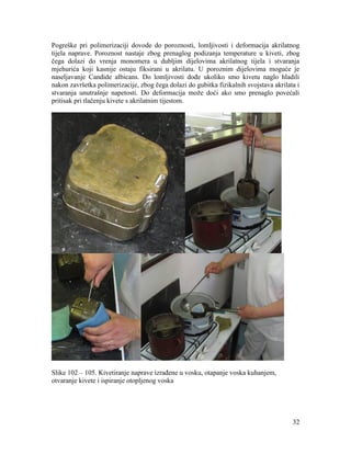 32
Pogreške pri polimerizaciji dovode do poroznosti, lomljivosti i deformacija akrilatnog
tijela naprave. Poroznost nastaje zbog prenaglog podizanja temperature u kiveti, zbog
čega dolazi do vrenja monomera u dubljim dijelovima akrilatnog tijela i stvaranja
mjehurića koji kasnije ostaju fiksirani u akrilatu. U poroznim dijelovima moguće je
naseljavanje Candide albicans. Do lomljivosti dođe ukoliko smo kivetu naglo hladili
nakon završetka polimerizacije, zbog čega dolazi do gubitka fizikalnih svojstava akrilata i
stvaranja unutrašnje napetosti. Do deformacija može doći ako smo prenaglo povećali
pritisak pri tlačenju kivete s akrilatnim tijestom.
Slike 102 – 105. Kivetiranje naprave izrađene u vosku, otapanje voska kuhanjem,
otvaranje kivete i ispiranje otopljenog voska
 