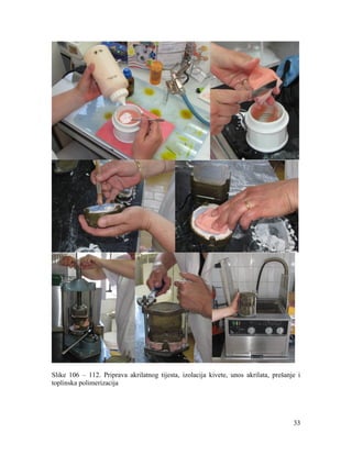 33
Slike 106 – 112. Priprava akrilatnog tijesta, izolacija kivete, unos akrilata, prešanje i
toplinska polimerizacija
 