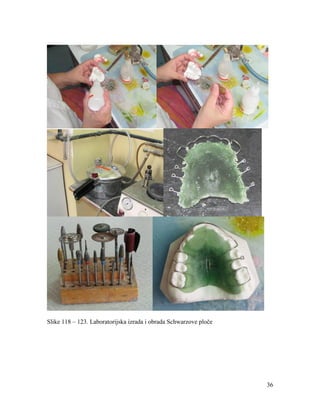 36
Slike 118 – 123. Laboratorijska izrada i obrada Schwarzove ploče
 