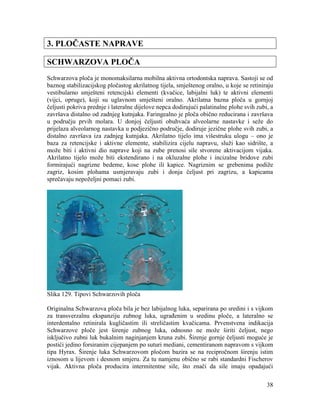 38
3. PLOČASTE NAPRAVE
SCHWARZOVA PLOČA
Schwarzova ploča je monomaksilarna mobilna aktivna ortodontska naprava. Sastoji se od
baznog stabilizacijskog pločastog akrilatnog tijela, smještenog oralno, u koje se retiniraju
vestibularno smješteni retencijski elementi (kvačice, labijalni luk) te aktivni elementi
(vijci, opruge), koji su uglavnom smješteni oralno. Akrilatna bazna ploča u gornjoj
čeljusti pokriva prednje i lateralne dijelove nepca dodirujući palatinalne plohe svih zubi, a
završava distalno od zadnjeg kutnjaka. Faringealno je ploča obično reducirana i završava
u području prvih molara. U donjoj čeljusti obuhvaća alveolarne nastavke i seže do
prijelaza alveolarnog nastavka u podjezično područje, dodiruje jezične plohe svih zubi, a
distalno završava iza zadnjeg kutnjaka. Akrilatno tijelo ima višestruku ulogu – ono je
baza za retencijske i aktivne elemente, stabilizira cijelu napravu, služi kao sidrište, a
može biti i aktivni dio naprave koji na zube prenosi sile stvorene aktivacijom vijaka.
Akrilatno tijelo može biti ekstendirano i na okluzalne plohe i incizalne bridove zubi
formirajući nagrizne bedeme, kose plohe ili kapice. Nagriznim se grebenima podiže
zagriz, kosim plohama usmjeravaju zubi i donja čeljust pri zagrizu, a kapicama
sprečavaju nepoželjni pomaci zubi.
Slika 129. Tipovi Schwarzovih ploča
Originalna Schwarzova ploča bila je bez labijalnog luka, separirana po sredini i s vijkom
za transverzalnu ekspanziju zubnog luka, ugrađenim u sredinu ploče, a lateralno se
interdentalno retinirala kugličastim ili streličastim kvačicama. Prvenstvena indikacija
Schwarzove ploče jest širenje zubnog luka, odnosno ne može širiti čeljust, nego
isključivo zubni luk bukalnim naginjanjem kruna zubi. Širenje gornje čeljusti moguće je
postići jedino forsiranim cijepanjem po suturi mediani, cementiranom napravom s vijkom
tipa Hyrax. Širenje luka Schwarzovom pločom bazira se na recipročnom širenju istim
iznosom u lijevom i desnom smjeru. Za tu namjenu obično se rabi standardni Fischerov
vijak. Aktivna ploča producira intermitentne sile, što znači da sile imaju opadajući
 