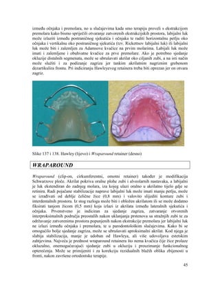 45
između očnjaka i premolara, no u slučajevima kada smo terapiju proveli s ekstrakcijom
premolara kako bismo spriječili otvaranje zatvorenih ekstrakcijskih prostora, labijalni luk
može izlaziti između postraničnog sjekutića i očnjaka te raditi horizontalnu petlju oko
očnjaka i vertikalnu oko postraničnog sjekutića (tzv. Rickettsov labijalni luk) ili labijalni
luk može biti i zalemljen za Adamsove kvačice na prvim molarima. Labijali luk može
imati i zalemljene i obuhvatne kvačice za prve premolare. Ako je potrebno sjedanje
okluzije distalnih segmenata, može se ubrušavati akrilat oko ciljanih zubi, a na isti način
može služiti i za podizanje zagriza jer tankim akrilatnim nagriznim grebenom
dezartikulira frontu. Pri indiciranju Hawleyevog retainera treba biti oprezan jer on otvara
zagriz.
Slike 137 i 138. Hawley (lijevo) i Wraparound retainer (desno)
WRAPAROUND
Wraparound (clip-on, cirkumferentni, omotni retainer) također je modifikacija
Schwarzove ploče. Akrilat pokriva oralne plohe zubi i alveolarnih nastavaka, a labijalni
je luk ekstendiran do zadnjeg molara, iza kojeg ulazi oralno u akrilatno tijelo gdje se
retinira. Radi pojačane stabilizacije naprave labijalni luk može imati manju petlju, može
se izrađivati od deblje čelične žice (0,8 mm) i valovito slijediti konture zubi i
interdentalnih prostora. Iz stog razloga može biti i obložen akrilatom ili se može dodatno
fiksirati tanjom žicom (0,5 mm) koja izlazi iz akrilata između lateralnih sjekutića i
očnjaka. Prvenstveno je indiciran za sjedanje zagriza, zatvaranje otvorenih
interproksimalnih područja preostalih nakon uklanjanja prstenova sa stražnjih zubi te za
održavanje zatvorenima prostora popunjenih nakon ekstrakcije premolara jer labijalni luk
ne izlazi između očnjaka i premolara, te u parodontološkim slučajevima. Kako bi se
omogućilo bolje sjedanje zagriza, može se ubrušavati aproksimalni akrilat. Kod njega je
slabija stabilizacija, manje je udoban od Hawleya, ali više udovoljava estetskim
zahtjevima. Najveća je prednost wraparound retainera što nema kvačica čije žice prolaze
okluzalno, onemogućavajući sjedanje zubi u okluziju i preuzimanje funkcionalnog
opterećenja. Može se primijeniti i za korekciju rezidualnih blažih oblika zbijenosti u
fronti, nakon završene ortodontske terapije.
 