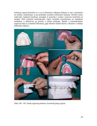 50
korekcije zagriza kontrolira se u sve tri dimenzije vađenjem bedema iz usta i umetanjem
na modele, orijentirajući se po prethodno ucrtanim referentnim linijama. Ukoliko nismo
zadovoljni stupnjem korekcije, postupak se ponavlja u ustima i ponovno kontrolira na
modelu. Neki ortodonti konstrukcijski zagriz inicijalno konstruiranju na studijskim
modelima, a definitivno ga postižu u ustima pacijenta. Modeli s konstrukcijskim
zagrizom šalju se u dentalni laboratorij, gdje tehničar modele fiksira u fiksatoru i izrađuje
funkcijsku napravu.
Slike 140 –145. Izrada zagriznog bedema i konstrukcijskog zagriza
 