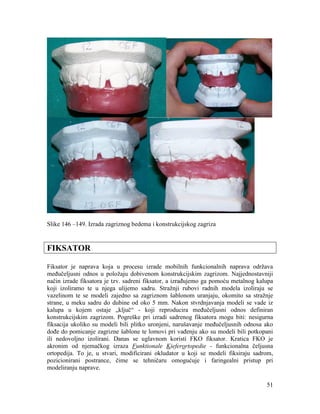 51
Slike 146 –149. Izrada zagriznog bedema i konstrukcijskog zagriza
FIKSATOR
Fiksator je naprava koja u procesu izrade mobilnih funkcionalnih naprava održava
međučeljusni odnos u položaju dobivenom konstrukcijskim zagrizom. Najjednostavniji
način izrade fiksatora je tzv. sadreni fiksator, a izrađujemo ga pomoću metalnog kalupa
koji izoliramo te u njega ulijemo sadru. Stražnji rubovi radnih modela izoliraju se
vazelinom te se modeli zajedno sa zagriznom šablonom uranjaju, okomito sa stražnje
strane, u meku sadru do dubine od oko 5 mm. Nakon stvrdnjavanja modeli se vade iz
kalupa u kojem ostaje „ključ“ - koji reproducira međučeljusni odnos definiran
konstrukcijskim zagrizom. Pogreške pri izradi sadrenog fiksatora mogu biti: nesigurna
fiksacija ukoliko su modeli bili plitko uronjeni, narušavanje međučeljusnih odnosa ako
dođe do pomicanje zagrizne šablone te lomovi pri vađenju ako su modeli bili potkopani
ili nedovoljno izolirani. Danas se uglavnom koristi FKO fiksator. Kratica FKO je
akronim od njemačkog izraza Funktionale Kieferortopedie - funkcionalna čeljusna
ortopedija. To je, u stvari, modificirani okludator u koji se modeli fiksiraju sadrom,
pozicionirani postrance, čime se tehničaru omogućuje i faringealni pristup pri
modeliranju naprave.
 