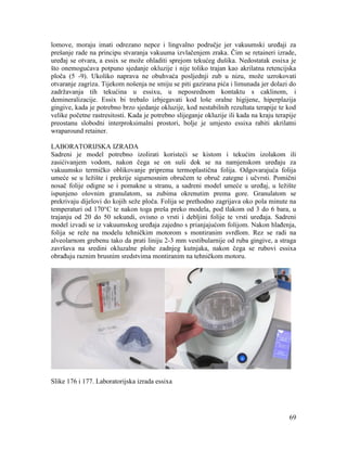 69
lomove, moraju imati odrezano nepce i lingvalno područje jer vakuumski uređaji za
prešanje rade na principu stvaranja vakuuma izvlačenjem zraka. Čim se retaineri izrade,
uređaj se otvara, a essix se može ohladiti sprejom tekućeg dušika. Nedostatak essixa je
što onemogućava potpuno sjedanje okluzije i nije toliko trajan kao akrilatna retencijska
ploča (5 -9). Ukoliko naprava ne obuhvaća posljednji zub u nizu, može uzrokovati
otvaranje zagriza. Tijekom nošenja ne smiju se piti gazirana pića i limunada jer dolazi do
zadržavanja tih tekućina u essixu, u neposrednom kontaktu s caklinom, i
demineralizacije. Essix bi trebalo izbjegavati kod loše oralne higijene, hiperplazija
gingive, kada je potrebno brzo sjedanje okluzije, kod nestabilnih rezultata terapije te kod
velike početne rastresitosti. Kada je potrebno slijeganje okluzije ili kada na kraju terapije
preostanu slobodni interproksimalni prostori, bolje je umjesto essixa rabiti akrilatni
wraparound retainer.
LABORATORIJSKA IZRADA
Sadreni je model potrebno izolirati koristeći se kistom i tekućim izolakom ili
zasićivanjem vodom, nakon čega se on suši dok se na namjenskom uređaju za
vakuumsko termičko oblikovanje priprema termoplastična folija. Odgovarajuća folija
umeće se u ležište i prekrije sigurnosnim obručem te obruč zategne i učvrsti. Pomični
nosač folije odigne se i pomakne u stranu, a sadreni model umeće u uređaj, u ležište
ispunjeno olovnim granulatom, sa zubima okrenutim prema gore. Granulatom se
prekrivaju dijelovi do kojih seže ploča. Folija se prethodno zagrijava oko pola minute na
temperaturi od 170°C te nakon toga preša preko modela, pod tlakom od 3 do 6 bara, u
trajanju od 20 do 50 sekundi, ovisno o vrsti i debljini folije te vrsti uređaja. Sadreni
model izvadi se iz vakuumskog uređaja zajedno s prianjajućom folijom. Nakon hlađenja,
folija se reže na modelu tehničkim motorom s montiranim svrdlom. Rez se radi na
alveolarnom grebenu tako da prati liniju 2-3 mm vestibularnije od ruba gingive, a straga
završava na sredini okluzalne plohe zadnjeg kutnjaka, nakon čega se rubovi essixa
obrađuju raznim brusnim sredstvima montiranim na tehničkom motoru.
Slike 176 i 177. Laboratorijska izrada essixa
 