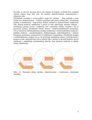 2
No kako se zub kao razvijeno tkivo teže mijenja od čeljusti, evolucija brže smanjuje
veličinu čeljusti nego broj zubi, što rezultira dentoalveolarnim nesrazmjernom i
zbijenošću zubi.
Ortodontske anomalije u svojoj podlozi mogu biti: skeletne – zbog nesklada u rastu
kostiju lica, dentoalveolarne – nesklad u položaju zubi unutar zubnog luka i alveolarnog
grebena te kombinirane - kada postoji skeletni nesklad uz dentoalveolarnu malpoziciju
zubi. Razlog korekcije malokluzija u prvom je redu ispravljanje narušene funkcije -
mastikacije, gutanja, govora i respiracije, kao i postizanje estetike osmijeha i lica te
prevencija karijesa, parodontnih bolesti, trauma i temporomandibularnih poremećaja.
Vrlo je intenzivna interdisciplinarna suradnja ortodoncije s ostalim područjima medicine i
dentalne medicine – parodontologijom, implantologijom, maksilofacijalnom i oralnom
kirurgijom, protetikom, restaurativom te fonijatrijom i logopedijom. Ortodontska terapija
u interdiciplinarnoj suradnji ima za cilj postizanje optimalnog odnosa i položaja kruna i
korjenova zubi, raspoređivanje zubi u zubnom luku i okluziji za aksijalni prijenos sila pri
mastikaciji i unapređenje parodontalnog zdravlja, čime pacijenta priprema za daljnju
oralnu rehabilitaciju.
Slike 3-5. Shematski prikaz skeletne, dentoalveolarne i kombinirane ortodontske
anomalije
 