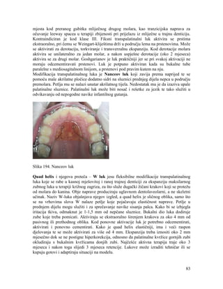 83
mjesta kod preranog gubitka mliječnog drugog molara, kao tranzicijska naprava za
očuvanje leeway spacea u terapiji zbijenosti pri prijelazu iz mliječne u trajnu denticiju.
Kontraindiciran je kod klase III. Fiksni transpalatinalni luk aktivira se prstima
ekstraoralno, pri čemu se Weingart-kliještima drži u području lema na prstenovima. Može
se aktivirati za derotaciju, torkviranje i transverzalnu ekspanziju. Kod derotacije molara
aktivira se unilateralno za jedan molar, a nakon uspješne derotacije (oko 2 mjeseca)
aktivira se za drugi molar. Goshgarianov je luk praktičniji jer se pri svakoj aktivaciji ne
moraju odcementiravati prstenovi. Luk je potpuno aktiviran kada su bukalne tube
paralelne s mediosagitalnom linijom, a prstenovi pod pravim kutem na nju.
Modifikacija transpalatinalnog luka je Nanceov luk koji zavija prema naprijed te se
pomoću male akrilatne pločice dodatno sidri na sluznici prednjeg dijela nepca u području
premolara. Petlja mu se nalazi unutar akrilatnog tijela. Nedostatak mu je da izaziva upale
palatinalne sluznice. Palatinalni luk može biti nosač i rešetke za jezik te tako služiti u
odvikavanju od nepogodne navike infantilnog gutanja.
Slika 194. Nanceov luk
Quad helix i njegova preteča – W luk jesu fleksibilne modifikacije transpalatinalnog
luka koje se rabe u kasnoj mješovitoj i ranoj trajnoj denticiji za ekspanziju maksilarnog
zubnog luka u terapiji križnog zagriza, za što služe dugački žičani krakovi koji se protežu
od molara do kanina. Obje naprave produciraju uglavnom dentolaveolarni, a ne skeletni
učinak. Naziv W-luka objašnjava njegov izgled, a quad helix je sličnog oblika, samo što
se na vrhovima slova W nalaze petlje koje pojačavaju elastičnost naprave. Petlje u
prednjem dijelu mogu služiti i za sprečavanje navike sisanja palca. Kako bi se izbjegla
iritacija tkiva, odmaknut je 1-1,5 mm od nepčane sluznice. Bukalni dio luka dodiruje
zube koje treba pomicati. Aktiviraju se ekstraoralno širenjem krakova za oko 4 mm od
pasivnog ili prethodnog oblika. Kod ponovne aktivacije luk je potrebno odcementirati,
aktivirati i ponovno cementirati. Kako je quad helix elastičniji, ima i veći raspon
djelovanja te se može aktivirati za više od 4 mm. Ekspanzija treba iznositi oko 2 mm
mjesečno dok se ne postigne hiperkorekcija, odnosno da palatinalne kvržice gornjih zubi
okludiraju s bukalnim kvržicama donjih zubi. Najčešće aktivna terapija traje oko 3
mjeseca i nakon toga slijedi 3 mjeseca retencije. Lukove može izraditi tehničar ili se
kupuju gotovi i adaptiraju situaciji na modelu.
 