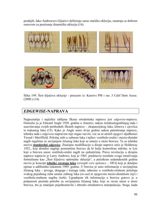 86
prednjih. Iako Andrewsovi ključevi definiraju samo statičku okluziju, smatraju se dobrom
osnovom za postizanje dinamičke okluzije (14).
Slika 199. Šest ključeva okluzije - preuzeto iz: Kasrovi PM i sur. J Calif Dent Assoc.
(2000.) (14).
EDGEWISE-NAPRAVA
Najpoznatija i najčešće rabljena fiksna ortodontska naprava jest edgewise-naprava.
Osmislio ju je Edward Angle 1928. godine u Americi, nakon četrdesetogodišnjeg rada i
usavršavanja svojih prethodnih fiksnih naprava – ekspanzijskog luka, klinova i cjevčica
te trakastog luka (15). Kako je Angle umro dvije godine nakon patentiranja naprave,
tehniku rada s edgewise-napravom nije stigao razviti, već su to učinili njegovi sljedbenici
Tweed i Meriffield. Položaj zubi u zubnom luku i njihov vestibulo-oralni i mezio-distalni
nagib regulirao se savijanjem žičanog luka koji se umeće u utore bravica. Ta se tehnika
naziva standardni edgewise. Značajne modifikacije u dizajn naprave unio je Holdaway
1952., koji distalno naginje postranične bravice da bi bolje kontrolirao sidrište, te Lee
koji u bravicu unosi vestibulo-oralni nagib na sjekutićima. Pravu revoluciju u dizajnu
naprave napravio je Larry Andrews, koji je 1965. predstavio rezultate svoga istraživanja
formulirane kao „Šest ključeva optimalne okluzije“, a početkom sedamdesetih godina
razvio je koncept tehnike ravnoga luka (straight wire apliance – SWA) koji je detaljno
opisan u udžbeniku tiskanom 1989. godine. U bravice je unio informacije o savijanjima
žičanog luka - prvoga, drugoga i trećega reda, odnosno u vestibulo-oralnom položaju
svakog pojedinog zuba unutar zubnog luka (in-out) te njegovom mezio-distalnom (tip) i
vestibulo-oralnom nagibu (tork). Ugradnjom tih informacija u bravice gotovo je u
potpunosti prestala potreba za savijanjima žičanog luka, koji se ravan unosi u utore
bravica, što je značajno pojednostavilo i ubrzalo ortodontovu manipulaciju. Stoga, kada
 