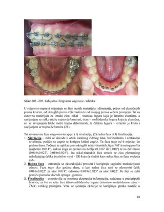 88
Slike 203 -205. Labijalna i lingvalna edgewise- tehnika
U edgewise-napravi mijenjaju se žice raznih materijala i dimenzija, počev od elastičnijih
prema krućim, od okruglih prema četvrtastim te od manjeg prema većem promjeru. Tri su
osnovna materijala za izradu žica: nikal – titanska legura koja je izrazito elastična, a
savijanjem se teško može trajno deformirati, titan – molibdenska legura koja je elastična,
ali se savijanjem lakše može trajno deformirati, te čelična legura – izrazito je kruta i
savijanjem se trajno deformira (21).
Tri su osnovne faze edgewise-terapije: (1) nivelacija, (2) radna faza i (3) finalizacija.
1. Nivelacija – zubi se dovode u oblik idealnog zubnog luka, horizontalno i vertikalno
niveliraju, podiže se zagriz te korigira križni zagriz. Ta faza traje od 6 mjeseci do
godinu dana. Počinje se aplikacijom okruglih nikal-titanskih žica (NiTi) malog profila
(najčešće 0.014''), nakon čega se prelazi na deblje (0.016'' ili 0.018'') te na četvrtaste
(0.016x0.022'', 0.018x0.025''). Iza nikal-titanskih žica umeće se žica plemenitog
nehrđajućeg čelika (stainless steel - SS) koja će služiti kao radna žica za fazu vođenja
zubi.
2. Radna faza – zatvaraju se ekstrakcijski prostori i korigiraju sagitalni međučeljusni
odnosi. Faza traje oko godinu dana, a kao radna žica rabi se plemeniti čelik
0.016x0.022'' za utor 0.018'', odnosno 0.019x0.025'' za utor 0.022'. Po žici se zubi
pomiču pomoću vlačnih opruga i gumica.
3. Finalizacija – uspostavlja se potpuna ekspresija informacija, sadržana u preskripciji
bravica, za što se rabe žice titan-molibdenske legure (titanium–molybdenum alloy –
TMA) velikog promjera. Vrše se sjedanja okluzije te korigiraju greške nastale u
 