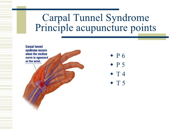 Pain Management by Acupuncture