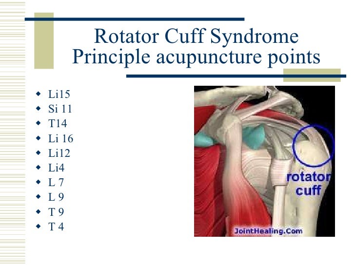 Pain Management by Acupuncture