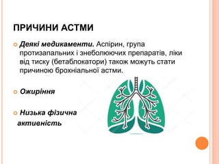 ПРИЧИНИ АСТМИ
 Деякі медикаменти. Аспірин, група
протизапальних і знеболюючих препаратів, ліки
від тиску (бетаблокатори) також можуть стати
причиною брохніальної астми.
 Ожиріння
 Низька фізична
активність
 