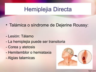 Hemiplejia Directa
• Talámica o síndrome de Dejerine Roussy:
- Lesión: Tálamo
- La hemiplejia puede ser transitoria
- Corea y atetosis
- Hemitemblor o hemiataxia
- Algias talamicas
 