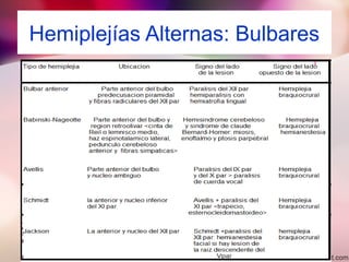 Hemiplejías Alternas: Bulbares
 