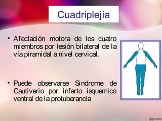 Cuadriplejía
• Afectación motora de los cuatro
miembros por lesión bilateral de la
víapiramidal anivel cervical.
• Puede observarse Sindrome de
Cautiverio por infarto isquemico
ventral delaprotuberancia
 