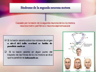 Causado por lalesión delasegundaneuronadelavíamotora,
neuronamotriz periféricao neuronaespinomuscular
 Si la lesión asientasobre los núcleosde origen
a nivel del tallo cerebral se habla de
paralisis nuclear
 Si la lesión asienta en algún punto del
trayecto de las fibras de la vía motora se dice
quelaparalisises infranuclear.
 