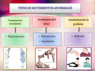 sindrome piramidal y extrapiramidal