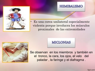 • Es una corea unilateral especialmente
violenta porque involucra los músculos
proximales de las extremidades
Se observan en los miembros y también en
el tronco, la cara, los ojos, el velo del
paladar , la faringe y el diafragma .
 