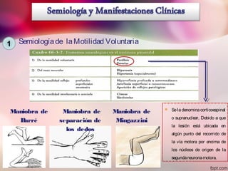1 Semiologíade laMotilidad Voluntaria
Maniobra de
Barré
Maniobra de
separación de
los dedos
Maniobra de
Mingazzini
 Se la denomina corticoespinal
o supranuclear, Debido a que
la lesión está ubicada en
algún punto del recorrido de
la vía motora por encima de
los núcleos de origen de la
segundaneuronamotora.
 