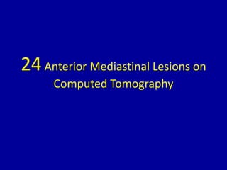 24Anterior Mediastinal Lesions on
Computed Tomography
 