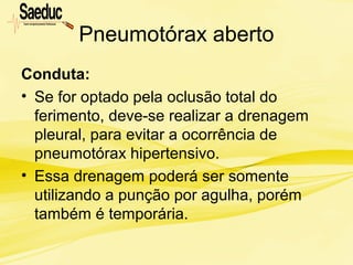 Pneumotórax aberto
Conduta:
• Se for optado pela oclusão total do
ferimento, deve-se realizar a drenagem
pleural, para evitar a ocorrência de
pneumotórax hipertensivo.
• Essa drenagem poderá ser somente
utilizando a punção por agulha, porém
também é temporária.
 