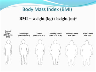 Normal
Weight
(BMI 18.5 to
24.9)
Overweight
(BMI 25 to 29.9)
Obese
(BMI 30 to 34.9)
Severely Obese
(BMI 35 to 39.9 )
Morbidly Obese
(BMI > 40)
Body Mass Index (BMI)
Super Obese
(BMI > 50)
BMI = weight (kg) / height (m)2
 