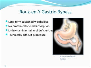 35
Roux-en-Y Gastric-Bypass
Long-term sustained weight loss
No protein-calorie malabsorption
Little vitamin or mineral deficiencies
Technically difficult procedure
Roux-en-Y Gastric
Bypass
 