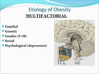 Etiology of Obesity
Familial
Genetic
Gender (F>M)
Social
Psychological (depression)
MULTIFACTORIAL
 
