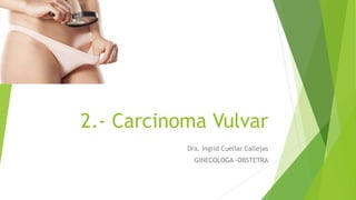 2.- Carcinoma Vulvar
Dra. Ingrid Cuellar Callejas
GINECOLOGA -OBSTETRA
 