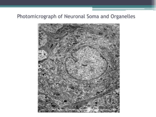 Photomicrograph of Neuronal Soma and Organelles
 