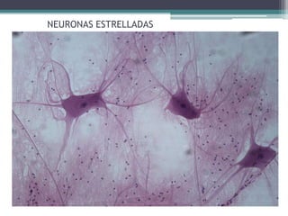 NEURONAS ESTRELLADAS
 
