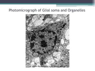 Photomicrograph of Glial soma and Organelles
 