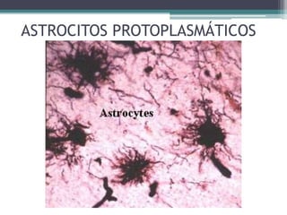 ASTROCITOS PROTOPLASMÁTICOS
 