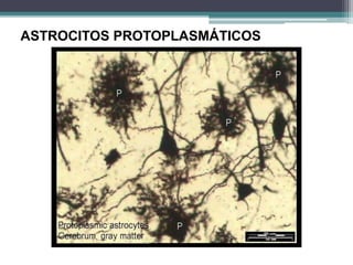 ASTROCITOS PROTOPLASMÁTICOS
 