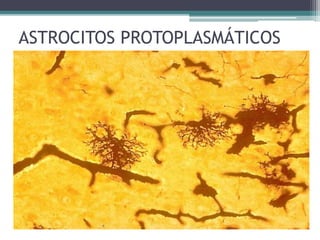 ASTROCITOS PROTOPLASMÁTICOS
 