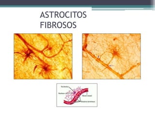 ASTROCITOS
FIBROSOS
 
