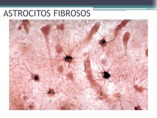 ASTROCITOS FIBROSOS
 