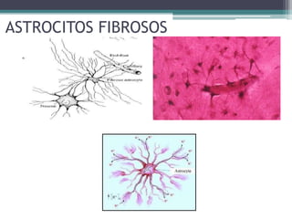 ASTROCITOS FIBROSOS
 